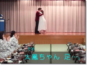 バービー、重症
