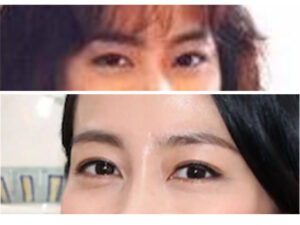 木村佳乃 目頭 顔変わった 整形