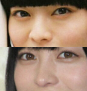 新しい学校のリーダーズ mizyu 橋本環奈 似てる 昔